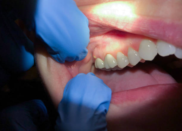 Best Pediatric Emergency Dentist in Lakewood, IL