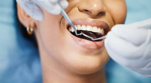 Best Same-Day Emergency Dentist in Lakewood, IL