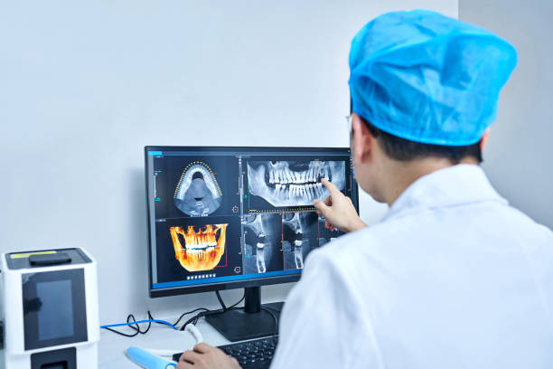 Best Emergency Root Canal Treatment in Lakewood, IL