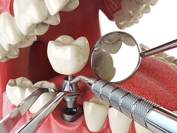 Best Walk-In Emergency Dentist in Lakewood, IL